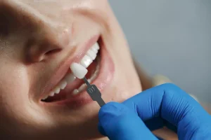 Best Dental Implants