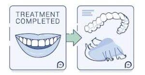 Types of Retainers After Braces