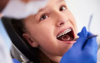 Teeth Braces Price in Lahore: What Patients Should Know Before Getting Braces