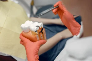 root canal cost pakistan