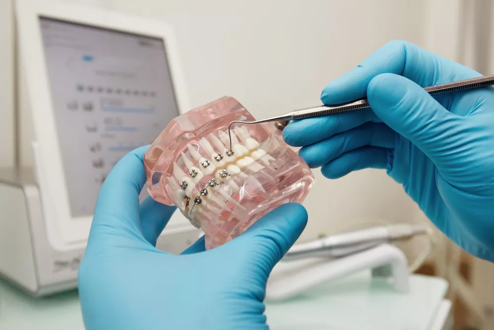 Teeth Braces Price in Lahore: Complete Cost Guide for 2026